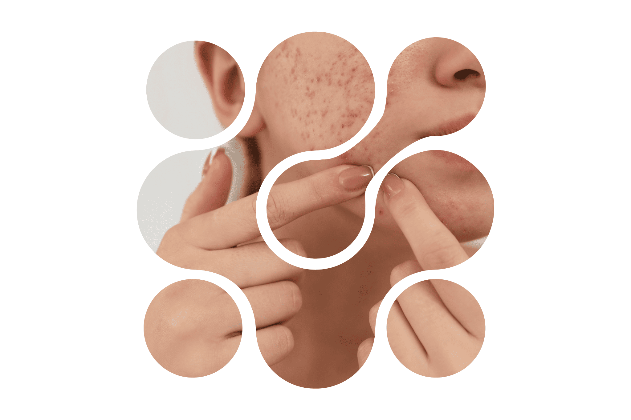 Une femme qui applique un patch bouton