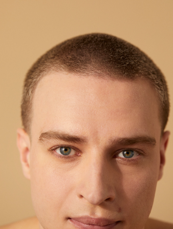 Un homme qui a fait une greffe IFA