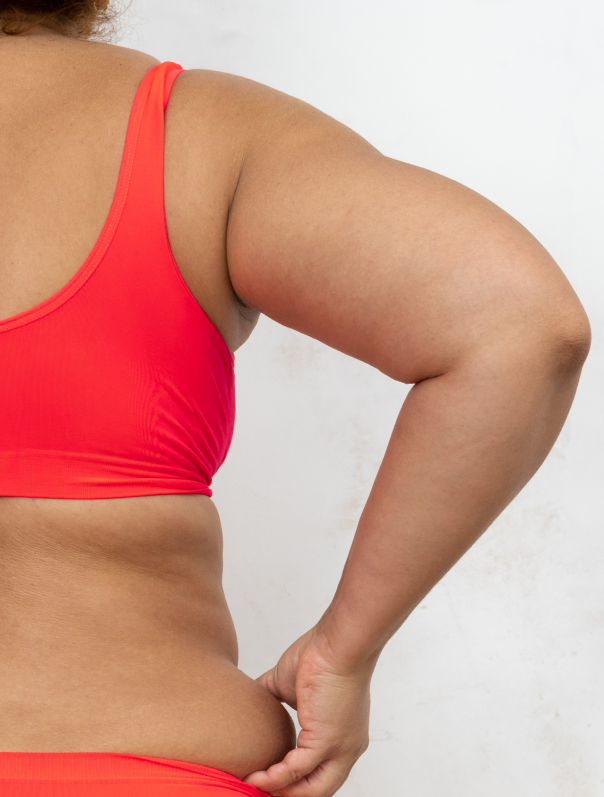 Une femme qui a des bras flasques