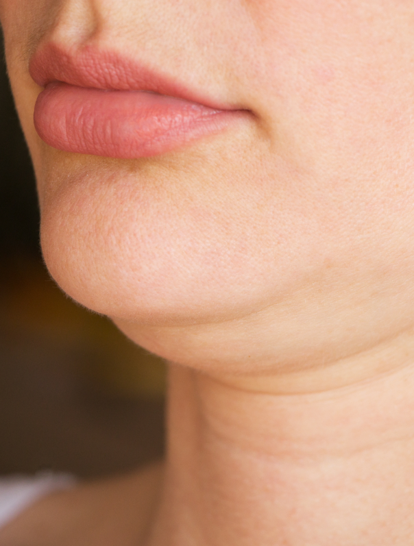 Une femme qui a de la cellulite sur le visage