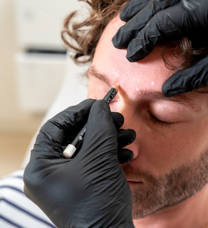 Les nouvelles tendances en matière de médecine esthétique en 2024 10 Zoom sur une séance d'injection de toxine botulique sur le front
