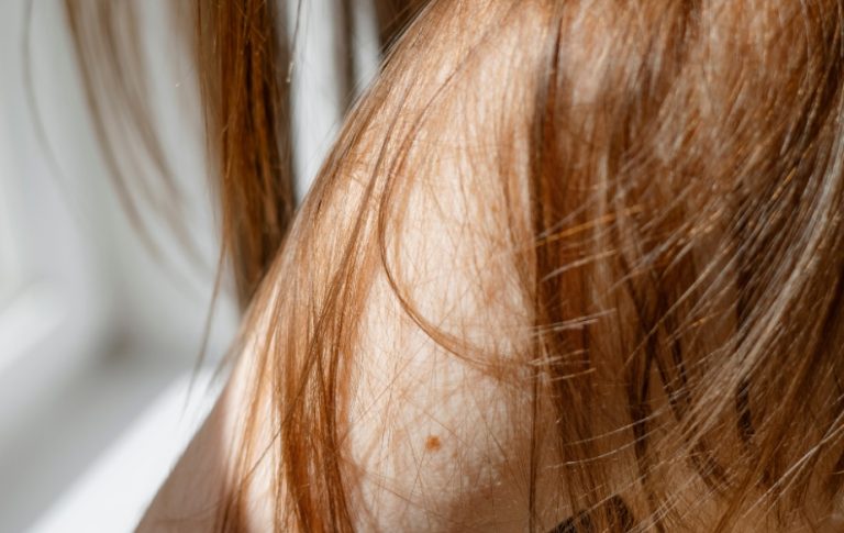 DHT et chute des cheveux : Les faits essentiels que vous devez savoir