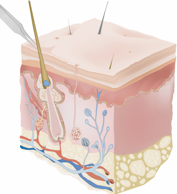 electrolyse definition