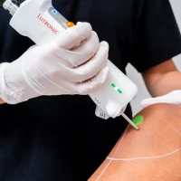 epilation laser jambes introduction 1