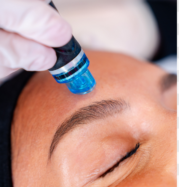 Hydrafacial chez aesthé