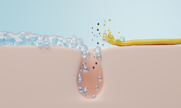 Schéma de l'action de l'hydrafacial sur la peau