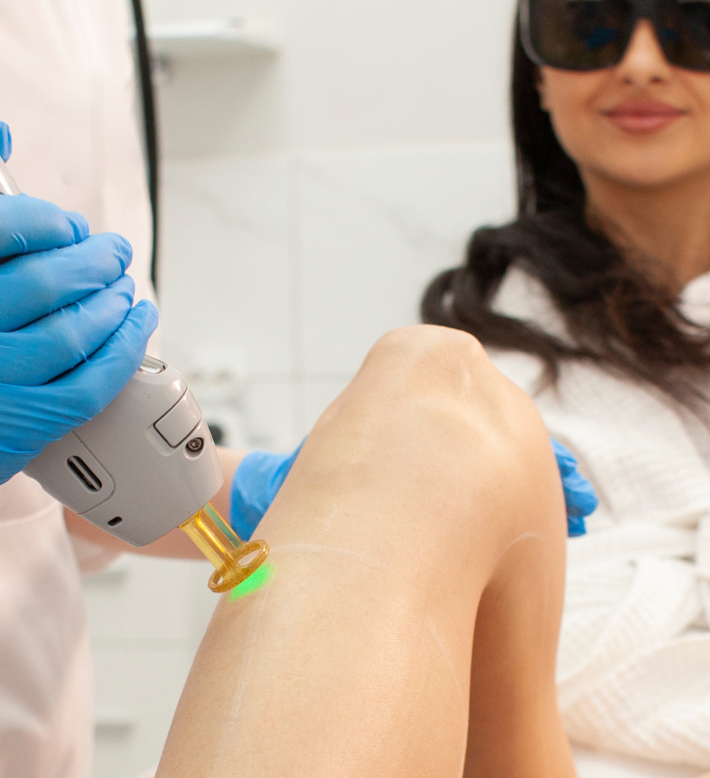 Séance d'épilation laser avec le laser Alexandrite