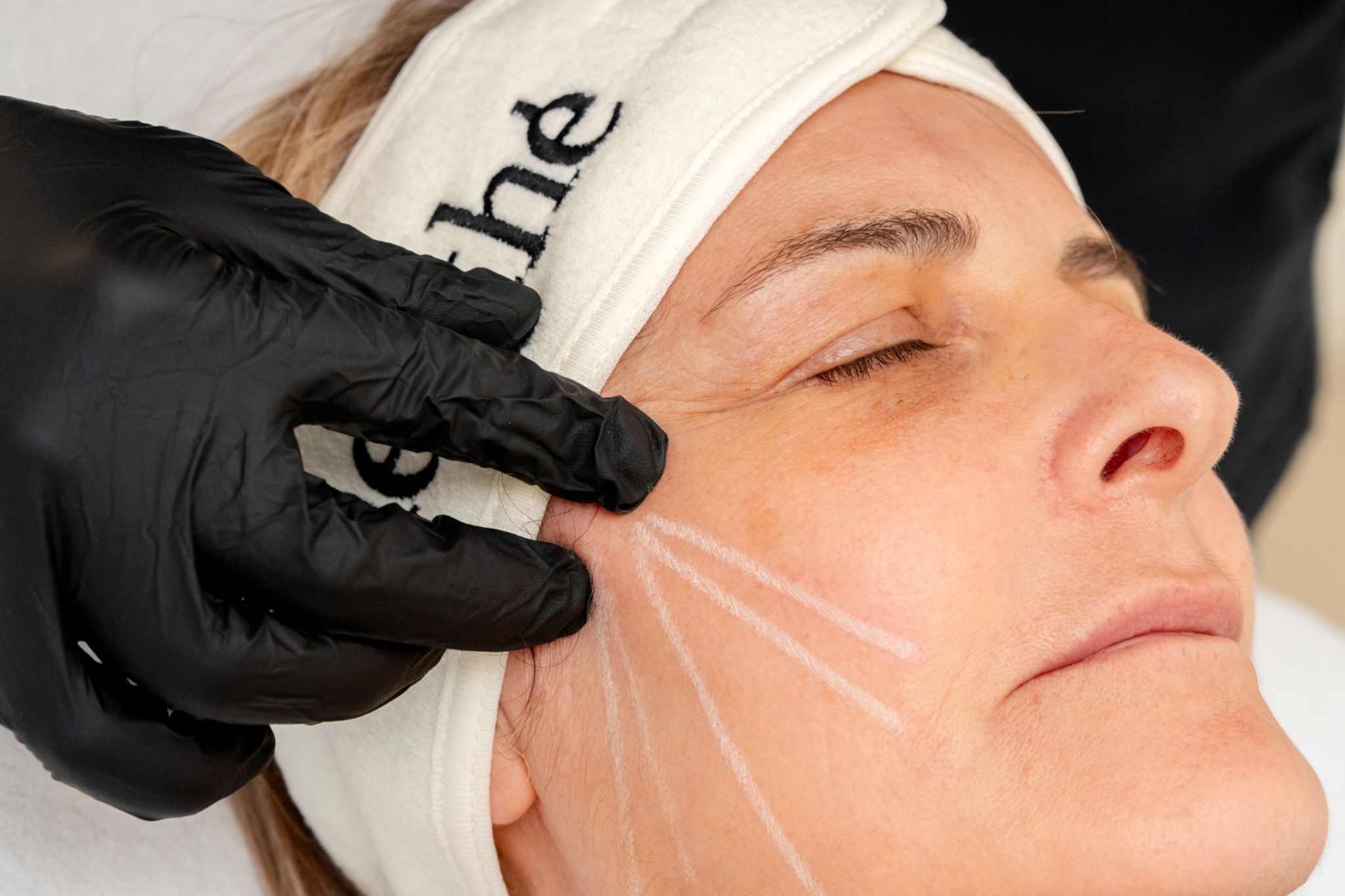 Ménopause et peau : quels sont les effets de la ménopause sur la peau