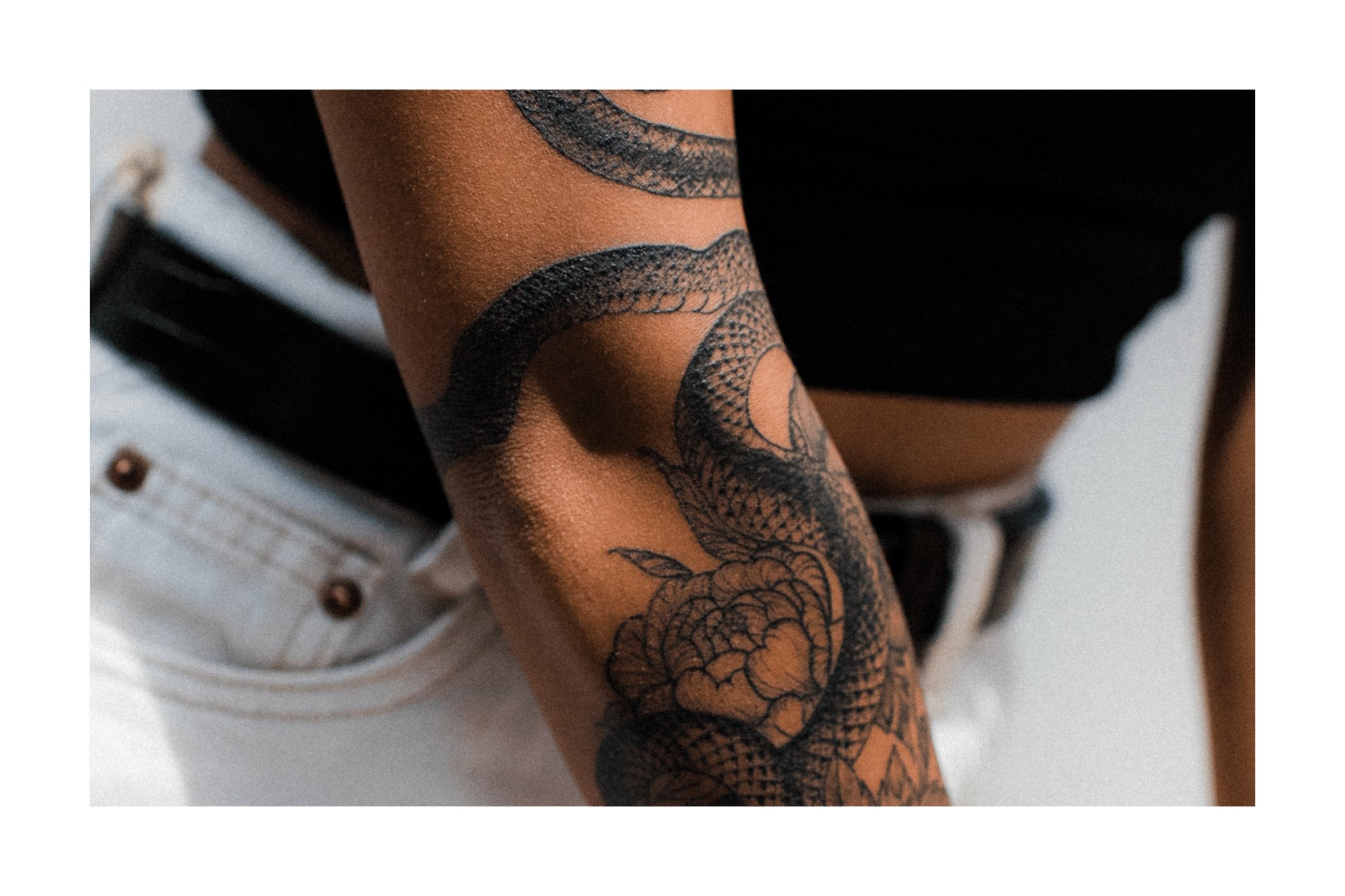 TOUTES NOS ADRESSES - INTE FINALE 35 Zoom sur un homme qui a fait une séance de détatouage laser