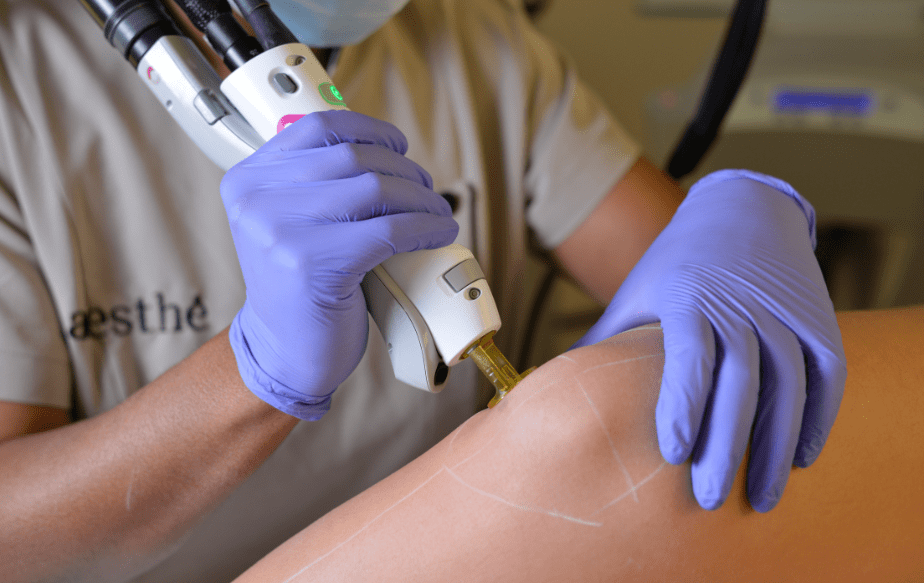 Épilation définitive en institut vs épilation à la maison : Comment