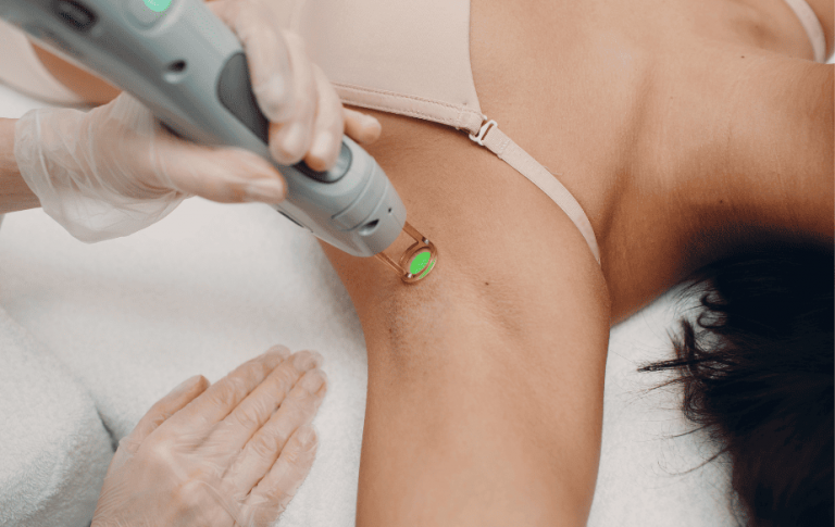 Séance d'épilation au laser sur les aisselles d'une femme