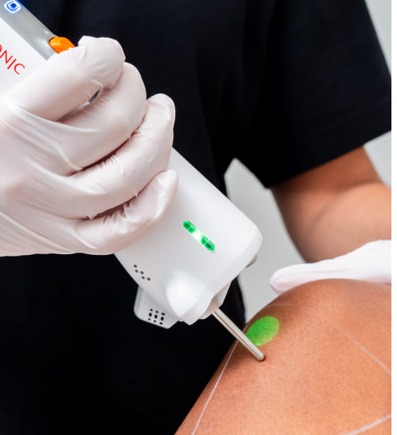 Séance épilation laser sur le menton d'une personne