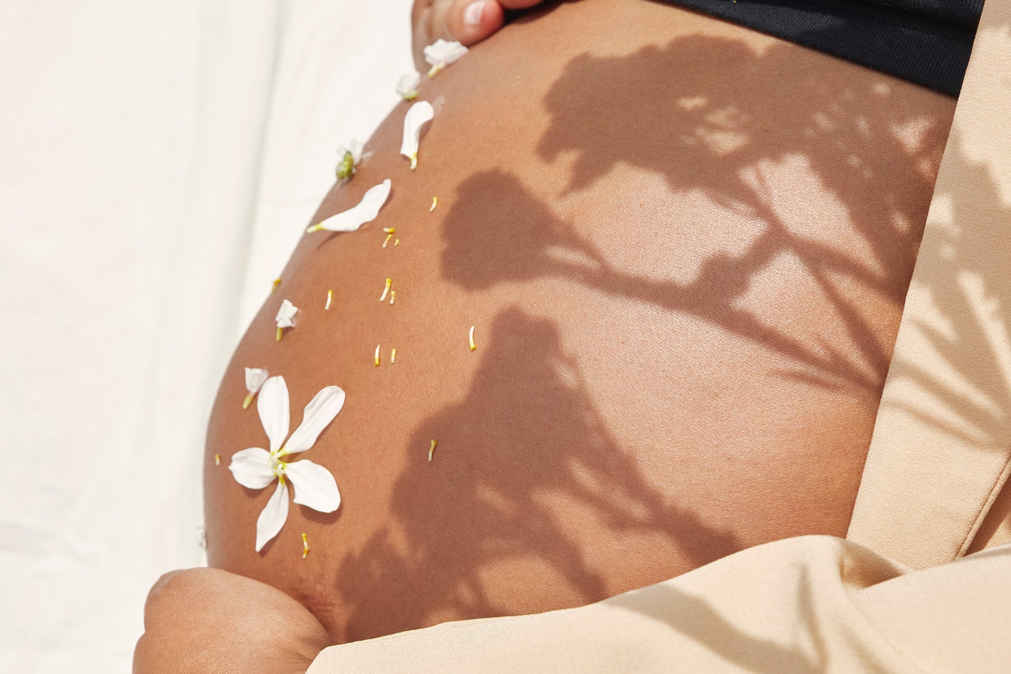 Une femme qui a des vergetures sur le ventre à cause de la grossesse